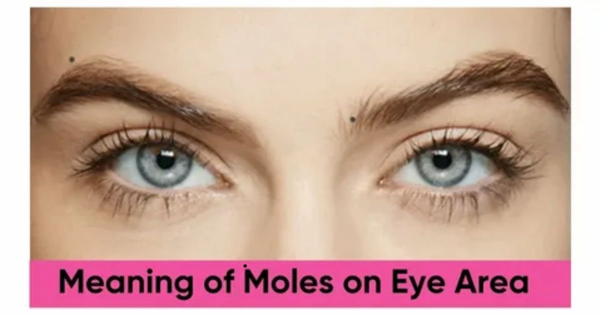 1.-Mole-on-the-Eyebrow.