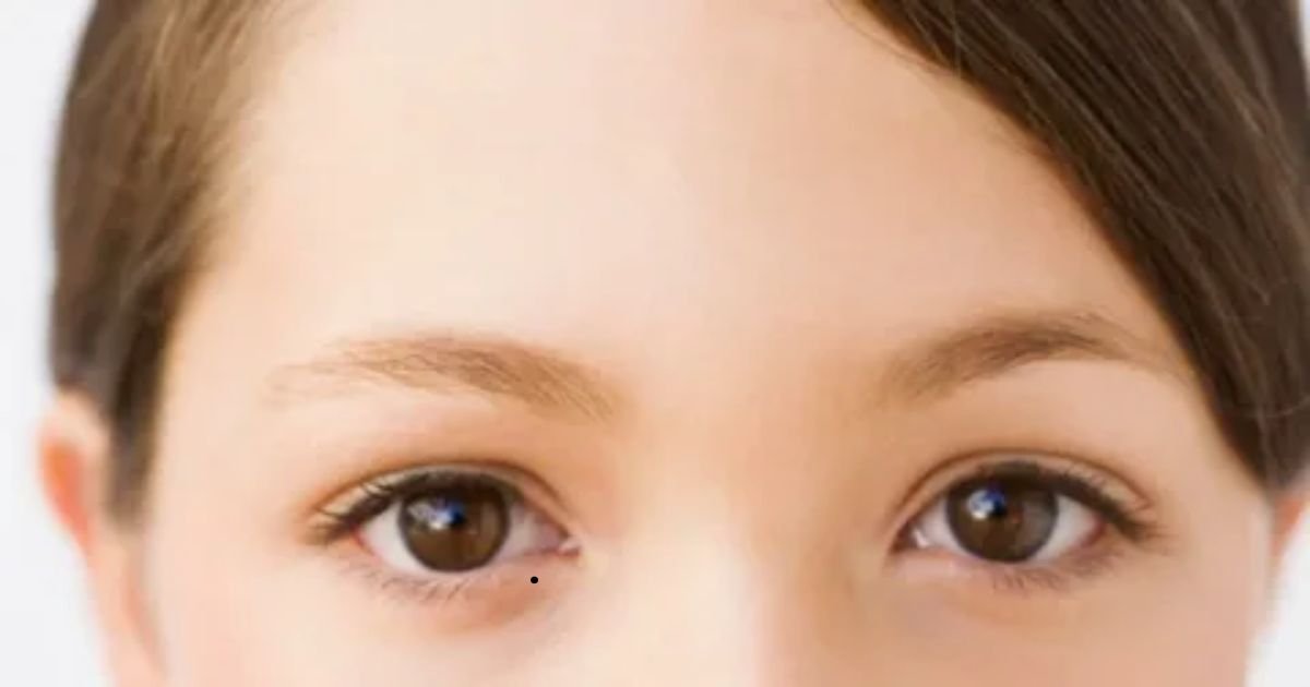 11-Spiritual-Meanings-of-Mole-on-the-Eye.