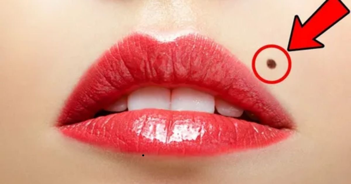 Meaning-of-Mole-on-the-Upper-and-Lower-Lips.