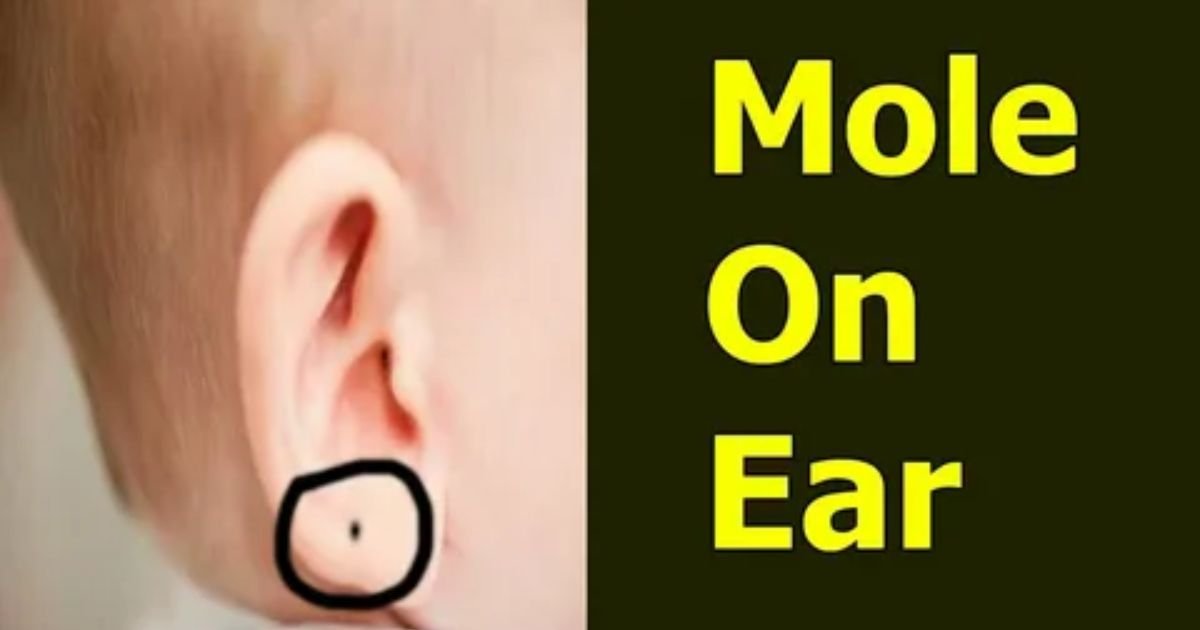 Mole-on-the-Ear-Meaning.
